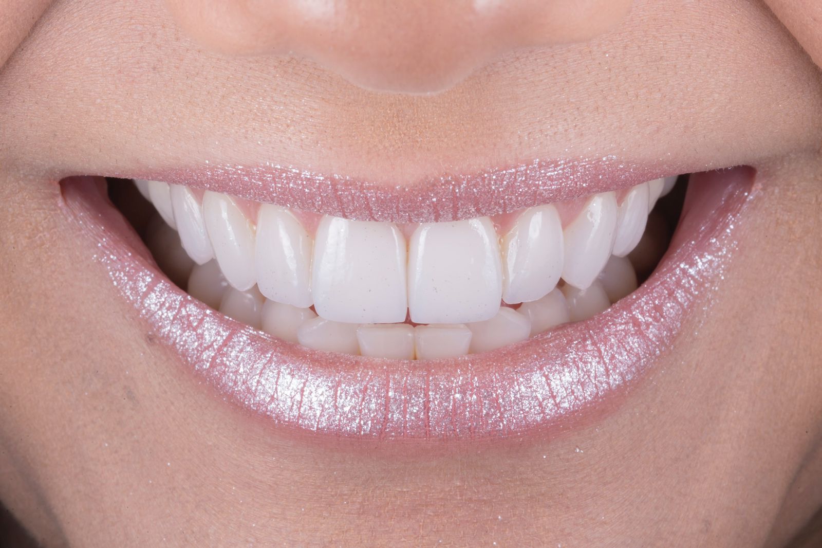 novo sorriso clareamento dental