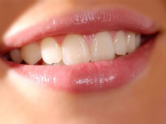 implante-dentario-goiania